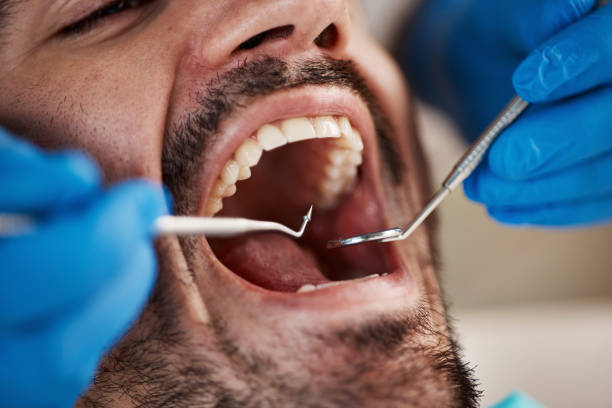 Dental X-Rays and Imaging in Denton, TX